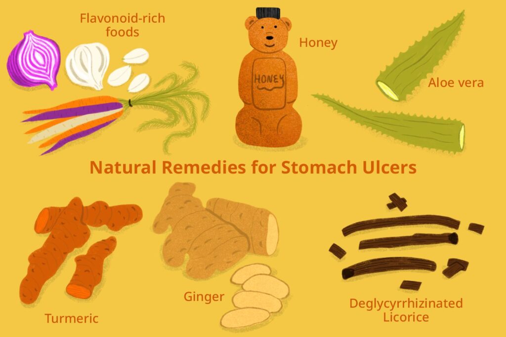 Stomach Soothers: Natural Remedies For Stomach Ulcers